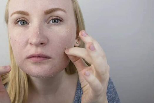 Les 5 mythes sur la peau grasse qui vous empêchent d&rsquo;en prendre soin correctement