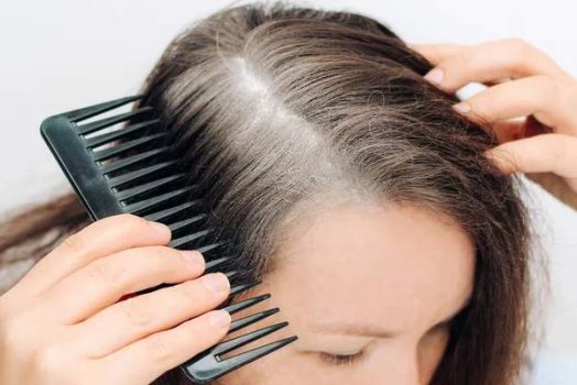 Comment purifier son cuir chevelu pour en finir avec les cheveux gras ?