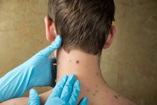 5 signes qu&rsquo;il est temps de consulter un dermatologue pour votre peau
