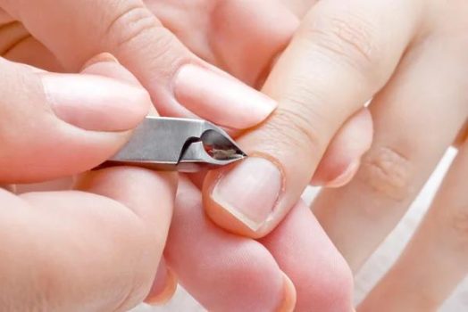 Inflammation des cuticules après manucure : que faire ?