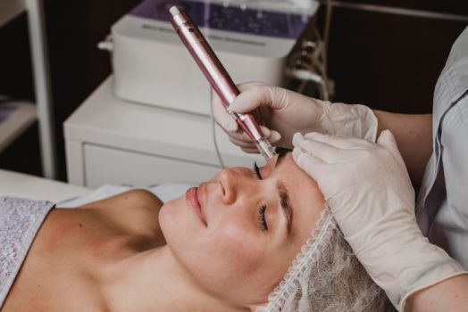 Peau terne, cicatrices, irrégularités : le microneedling est-il adapté ?